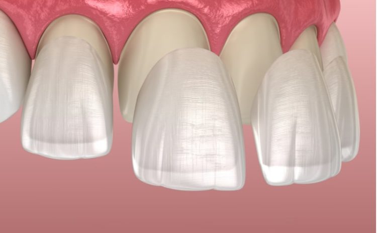  Dental Crowns: What Are They, Types, Procedure & Care