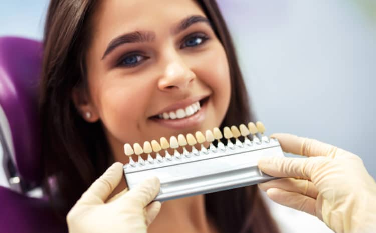  What is Teeth Whitening and Why it is Required?