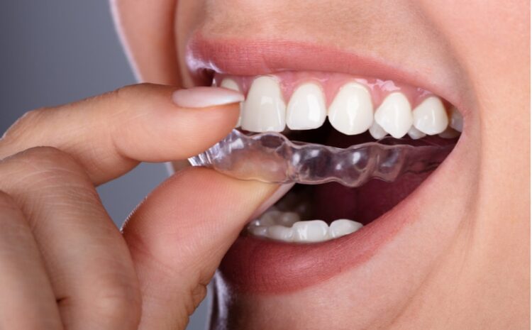  Ortho treatment for teeth – an Affordable and Effective Solution for Teeth Loss